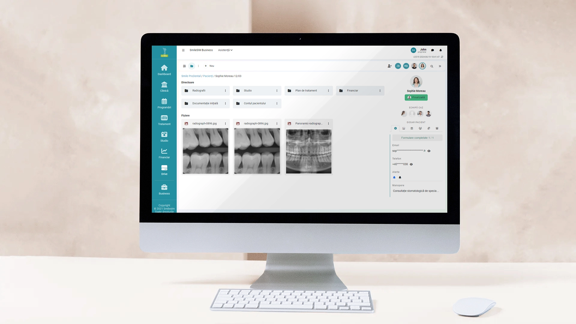 Vista previa de la característica de la aplicación de software del módulo del Cloud