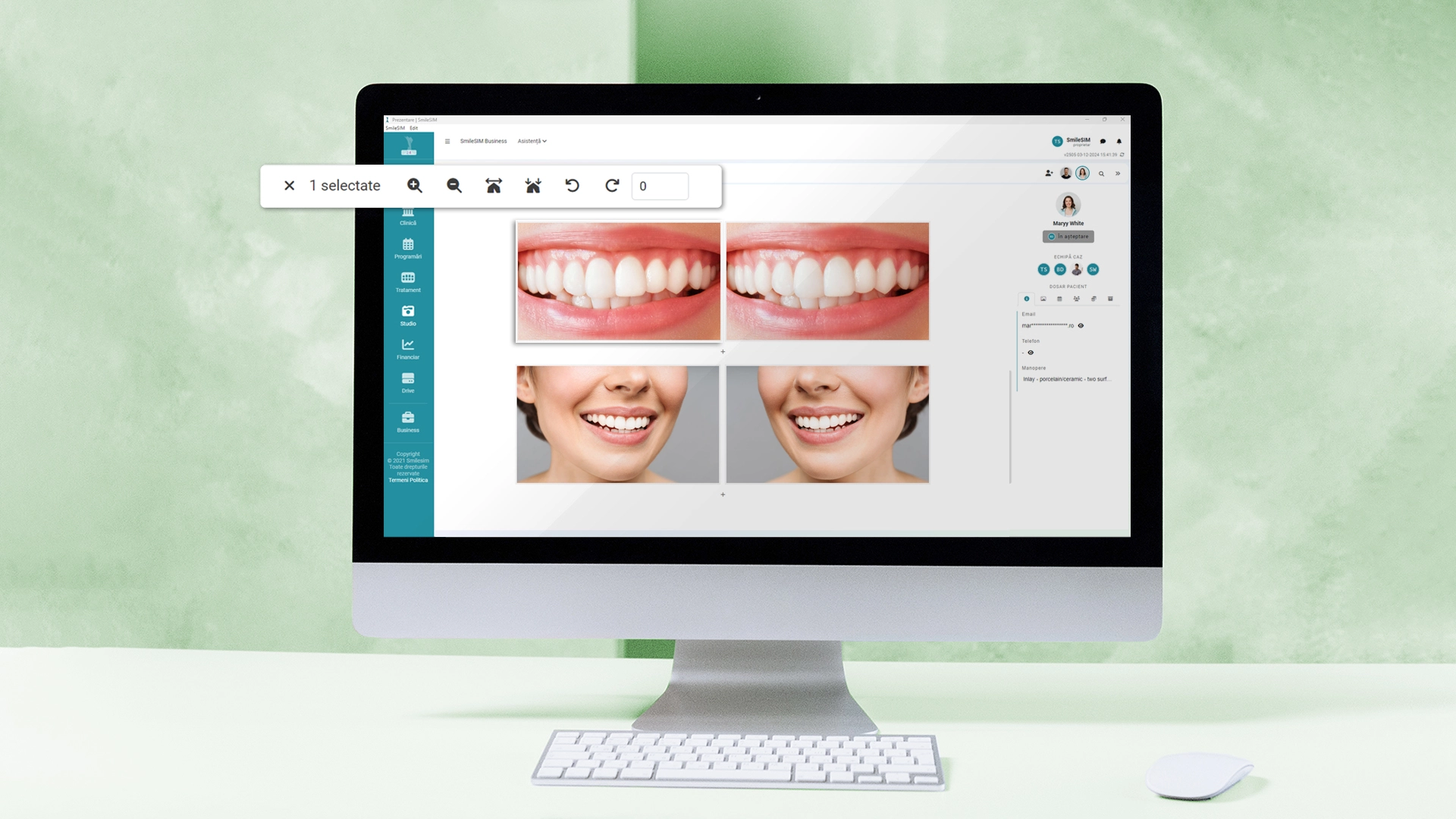 La función Edición de fotos del módulo de software {1}